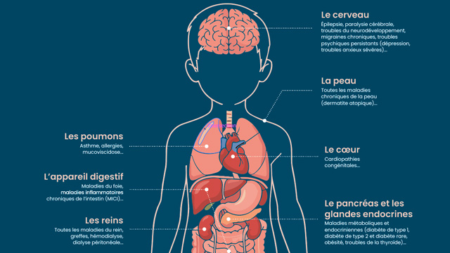 Aperçu de l'infographie (planche anatomie avec les organes permettant de montrer les maladies chroniques chez l'enfant) sur fond bleu foncé