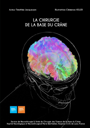 Couverture BD la chirurgie de la base du crâne