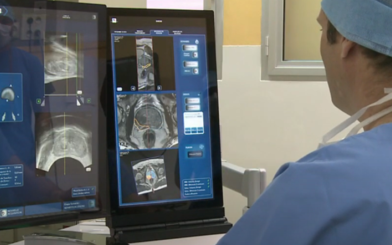Traitement ciblé du cancer de la prostate par le professeur Sébastien Crouzet