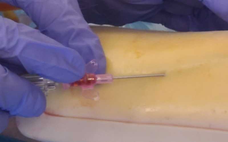 Lorsque l’aiguille est insérée dans la veine artificielle du mannequin de simulation, un reflux de faux sang apparaît, preuve que l’aiguille est bien positionnée