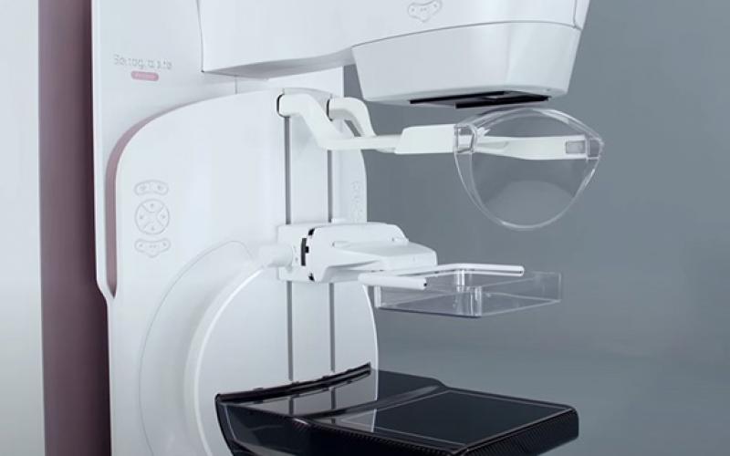 Nouveau mammographe Pristina, développé par GE Healthcare