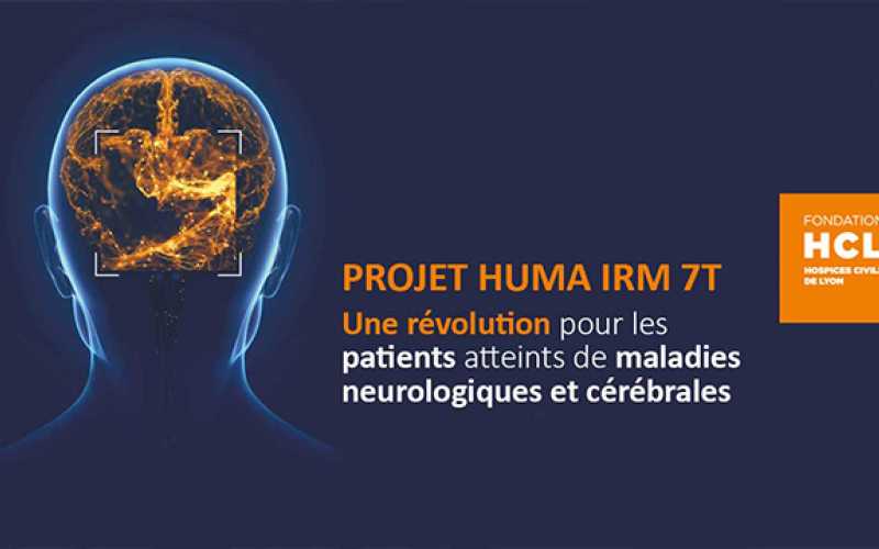 IRM avec cerveau