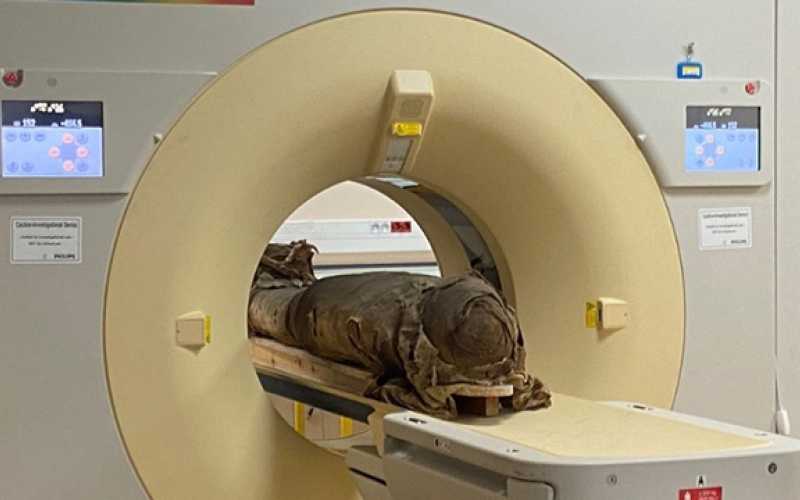 scanner spectral à comptage photonique (SPCCT) et momie