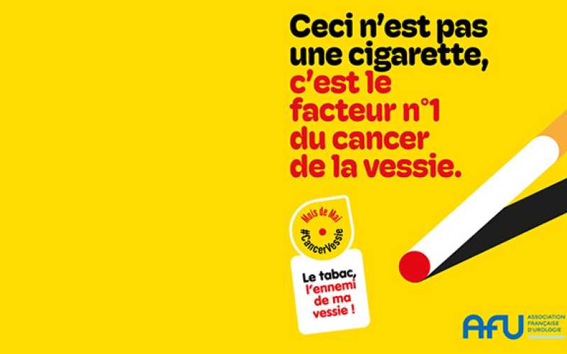 Mois de mai #cancervessie avec cigarette