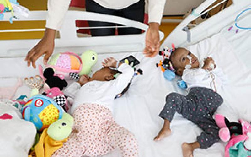 Bissie et Eyenga Merveille, deux siamoises camerounaises ont été séparées le mercredi 13 novembre 2019 à Lyon