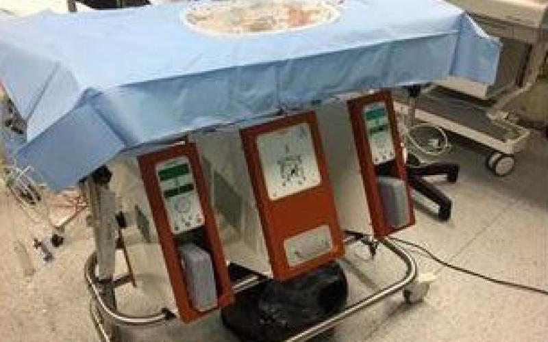 Greffe hépatique : une nouvelle machine qui optimise le greffon