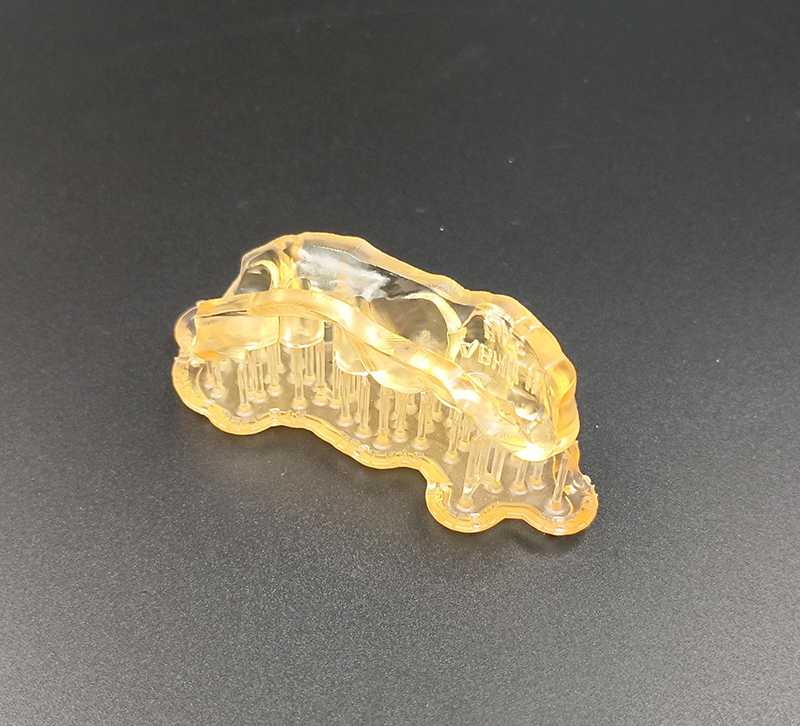 Guide chirurgicale après impression par l'imprimante 3D