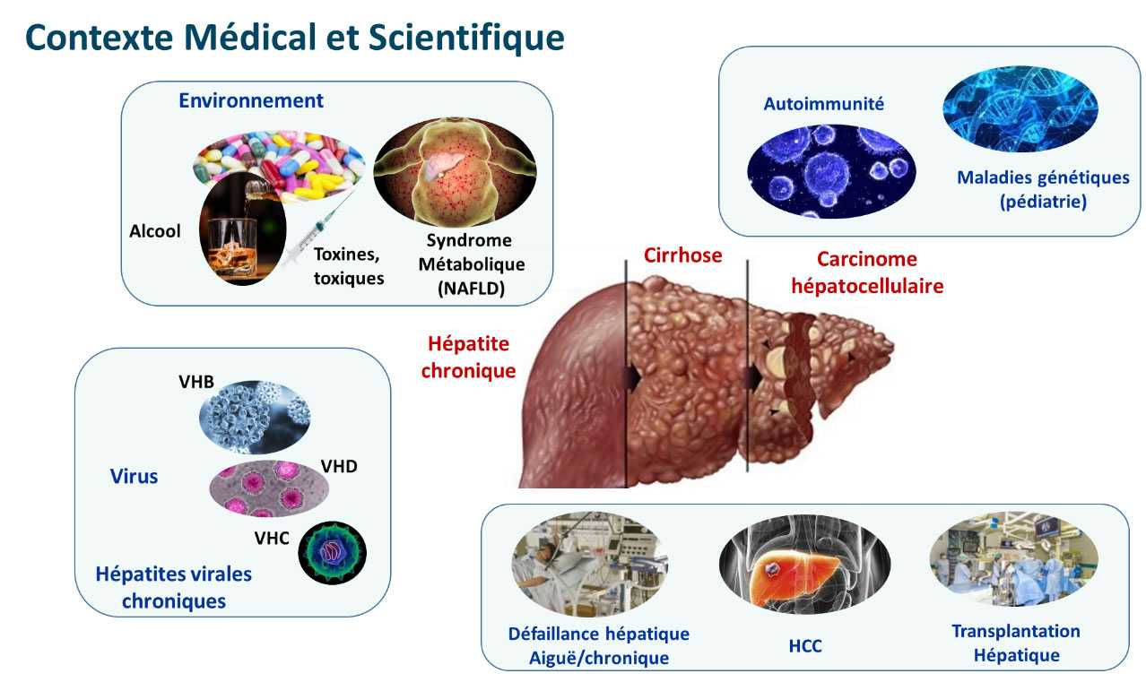 Contexte médical et scientifique - Axe de recherche hépatologie
