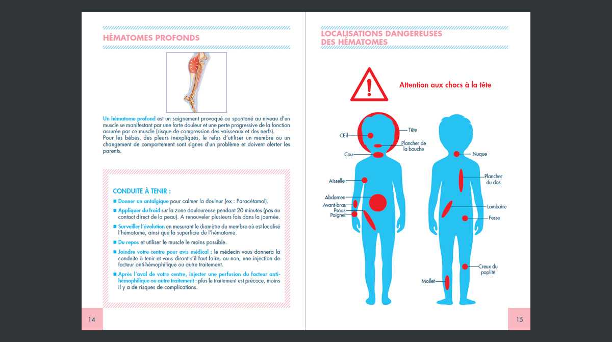 Le syndrome hémorragique du nouveau-né