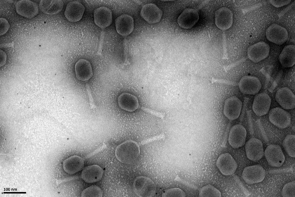 Observation au microscope électronique de phages thérapeutiques anti-Staphylococcus aureus (V1SA19) produits aux Hospices Civils de Lyon