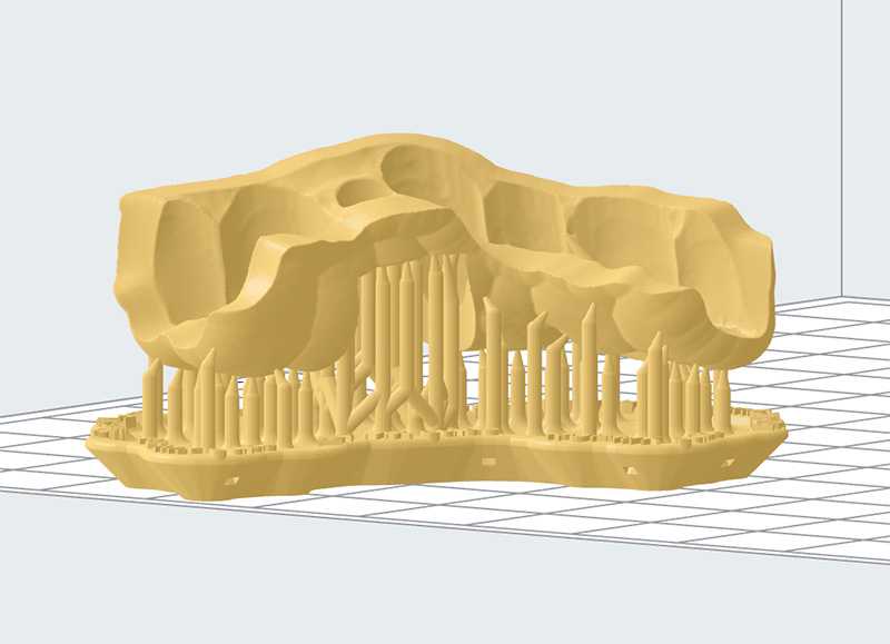 Fichier stl du guide issu du projet implantaire avec le praticien