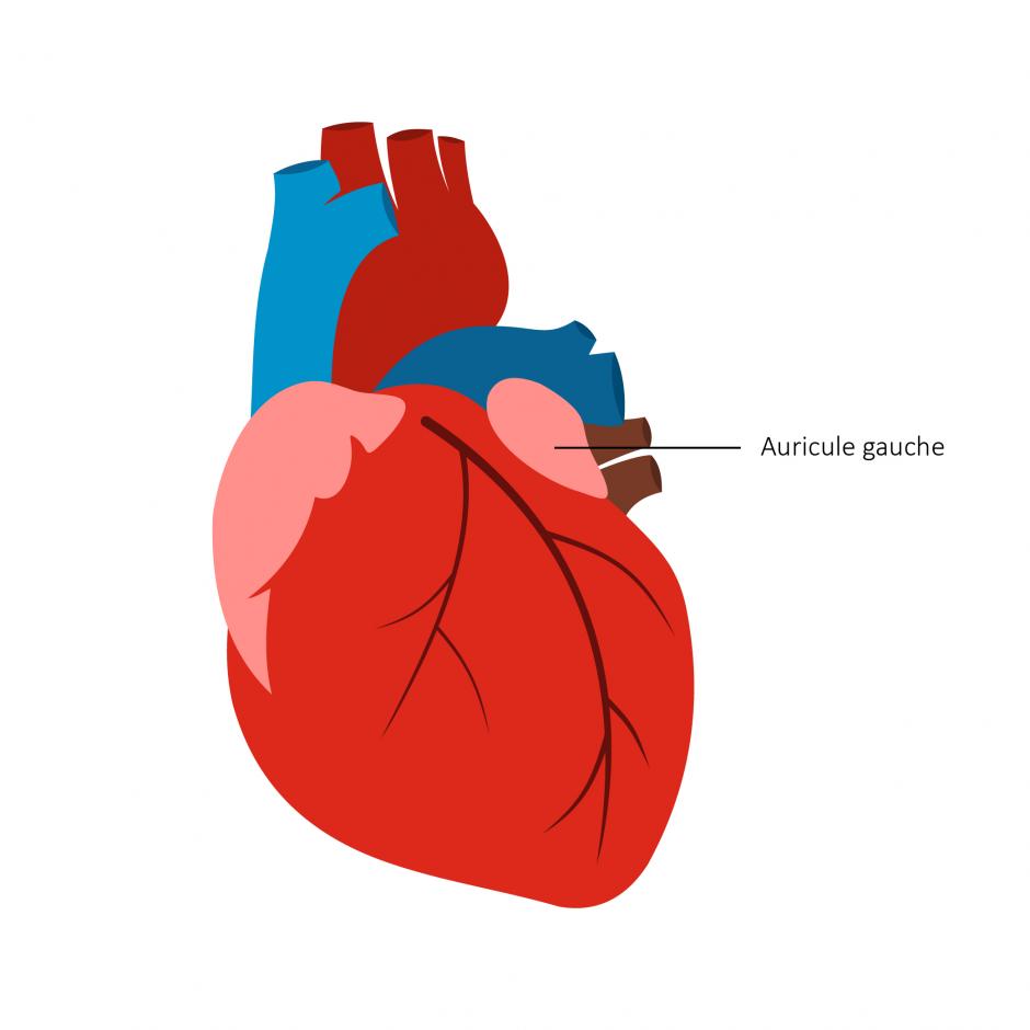 100ème prothèse de fermeture d’auricule gauche Hospices Civils de Lyon CHU de Lyon 100ème prothèse de fermeture d’auricule gauche Hospices Civils de Lyon CHU de Lyon